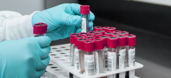 SANOK: Są wstępne wyniki badań. To salmonella