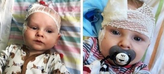 Armia Kubusia pomogła Miłoszkowi. Zebrano całą potrzebną kwotę na operację w USA